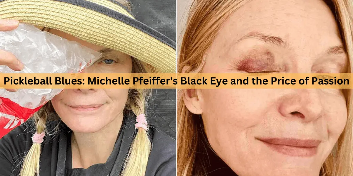 Pickleball Blues: Michelle Pfeiffer’s Black Eye and the Price of Passion
